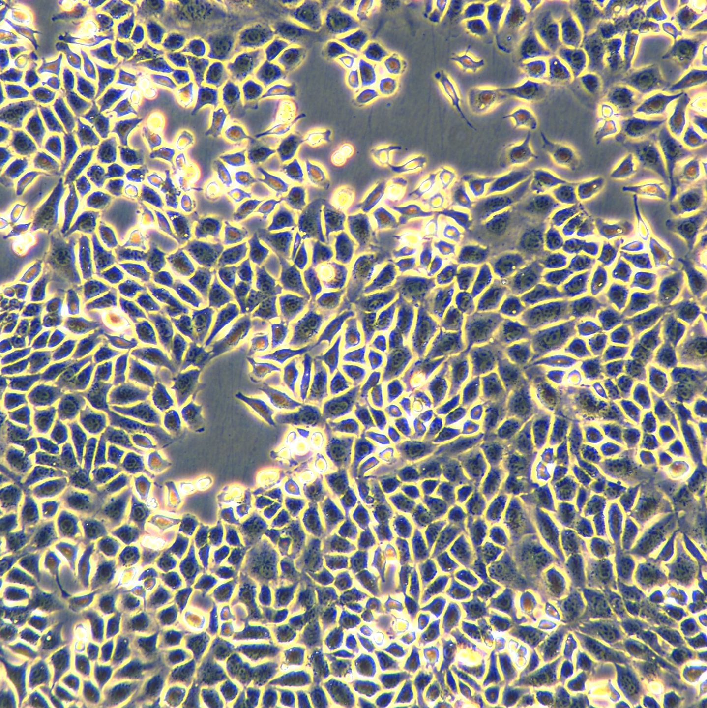 小鼠卵巢癌细胞 ID8