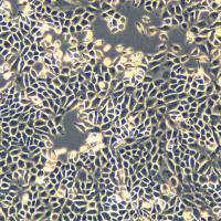 小鼠卵巢癌细胞 ID8