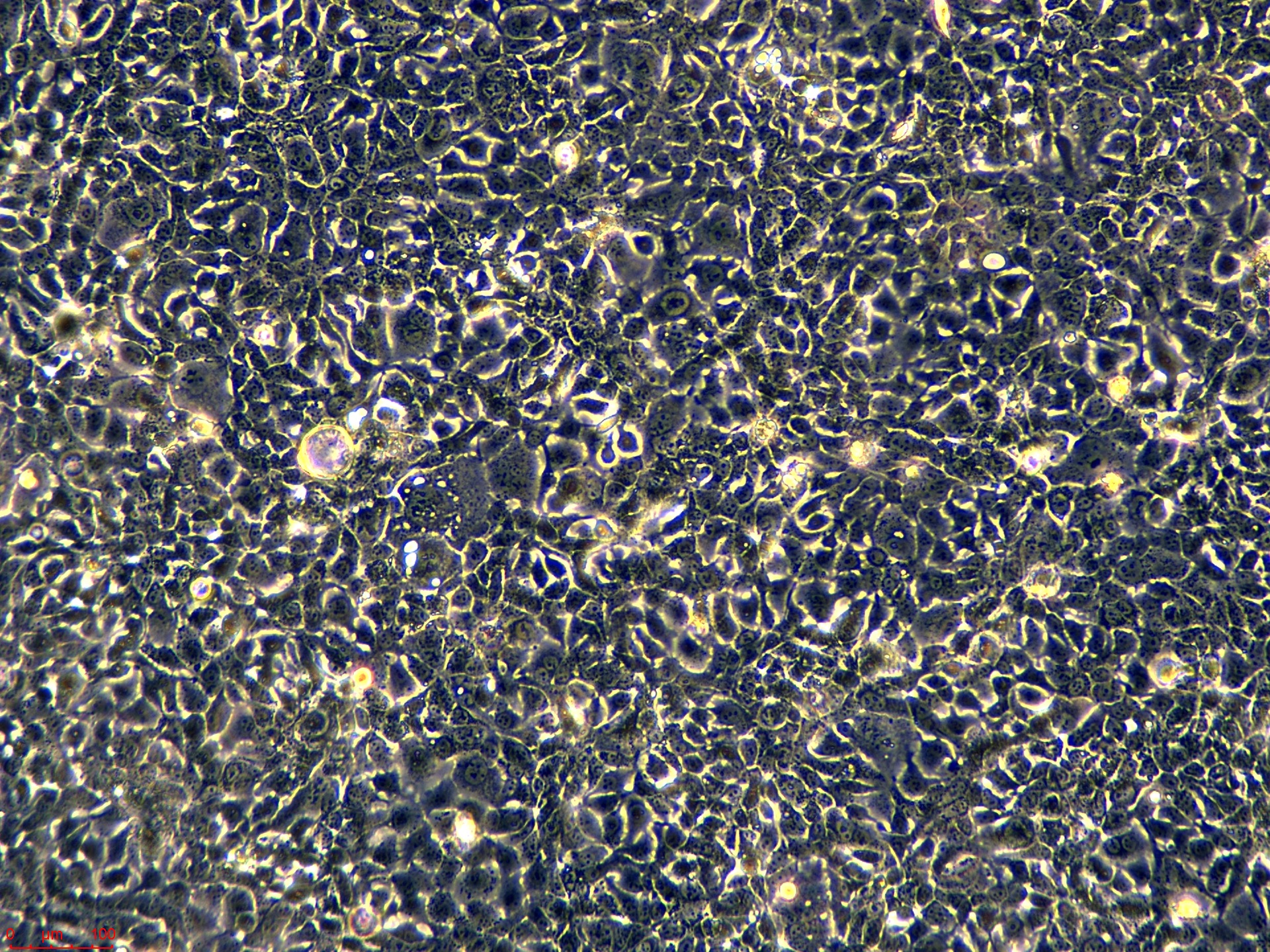 Project_HCC1937_ch00 (2).jpg