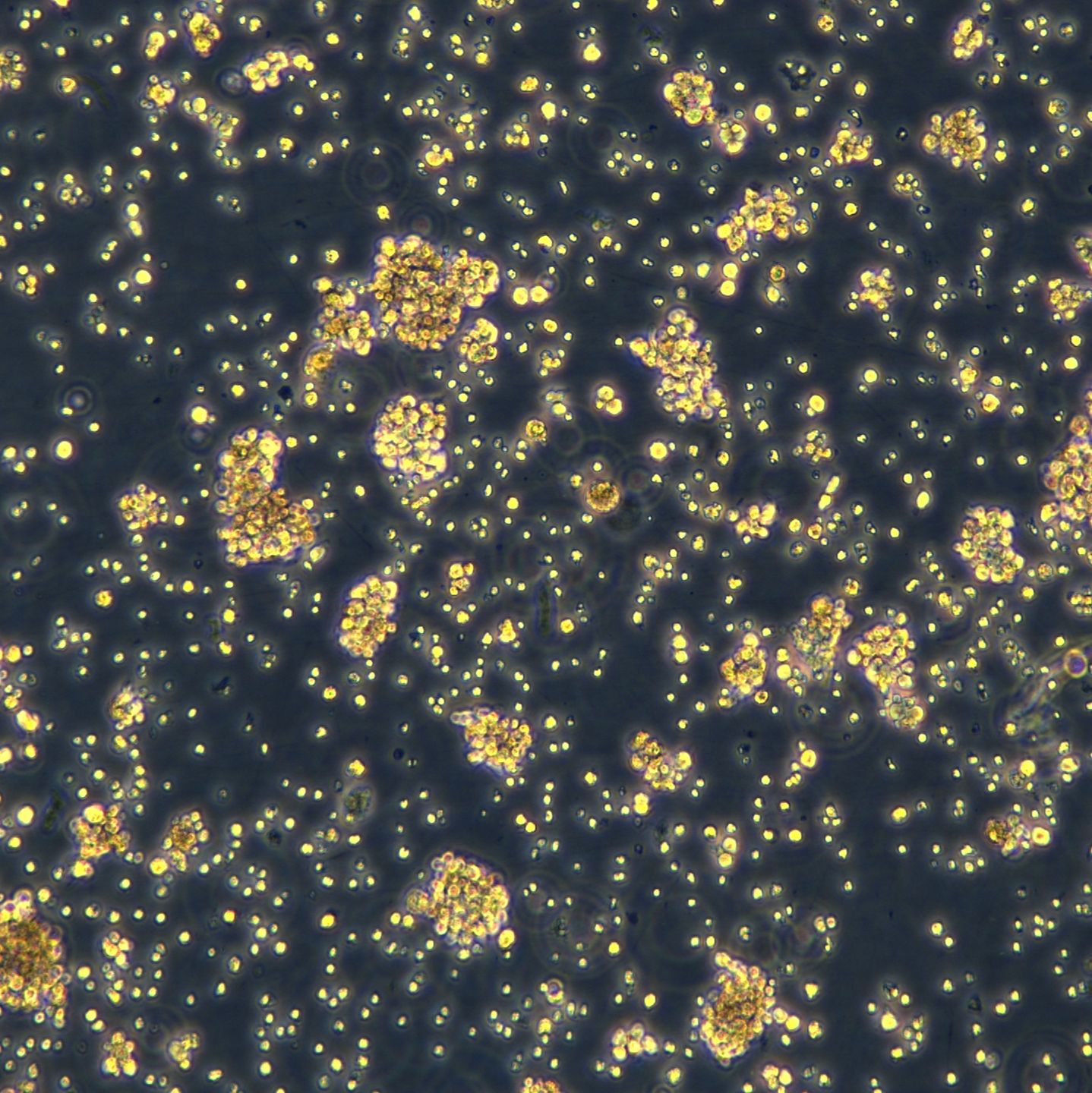 弥漫性大B细胞淋巴瘤 TMD8