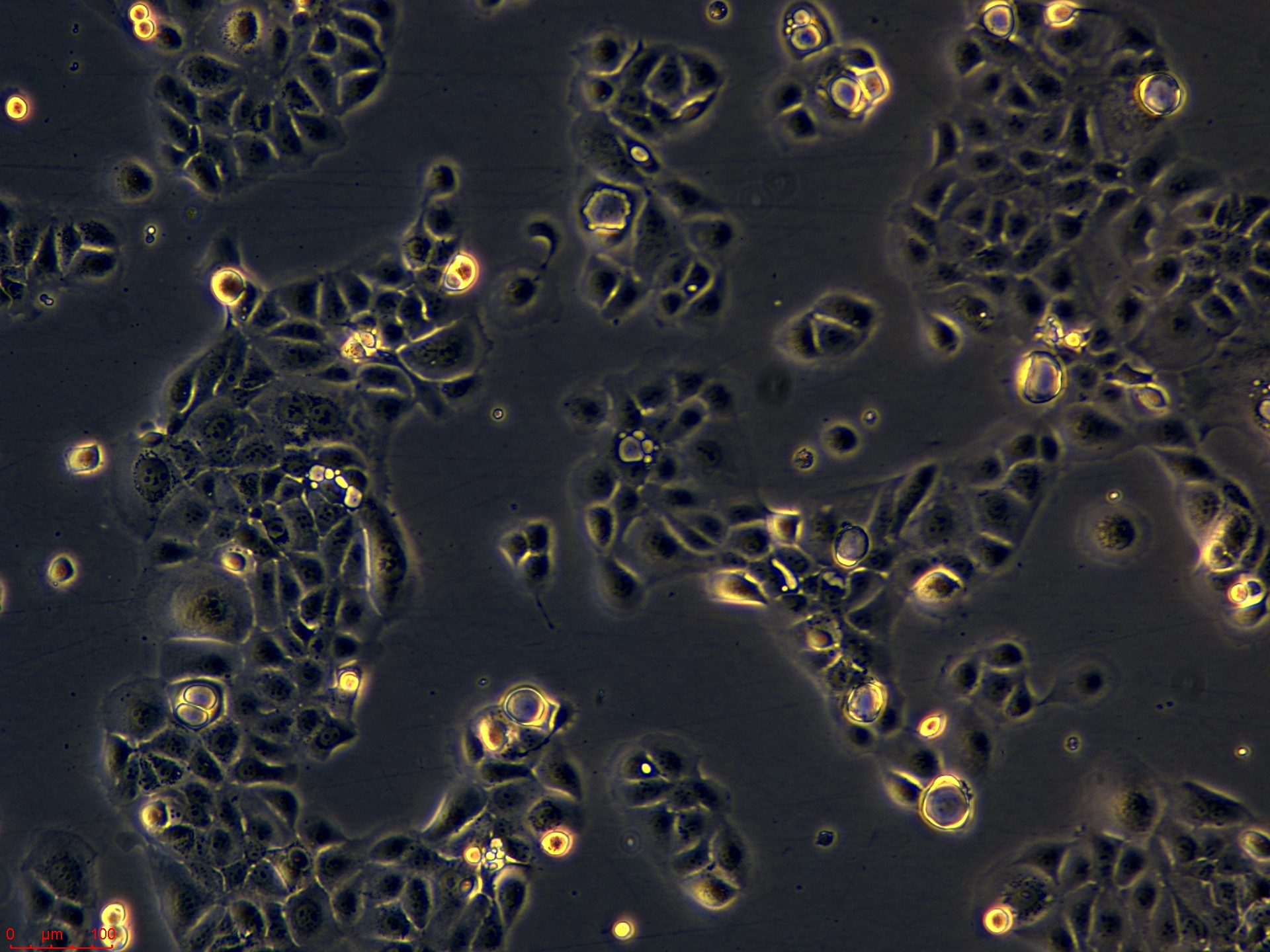 Project_HCC1937_ch00 (4).jpg