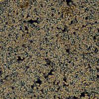 人胃癌细胞 MKN-45