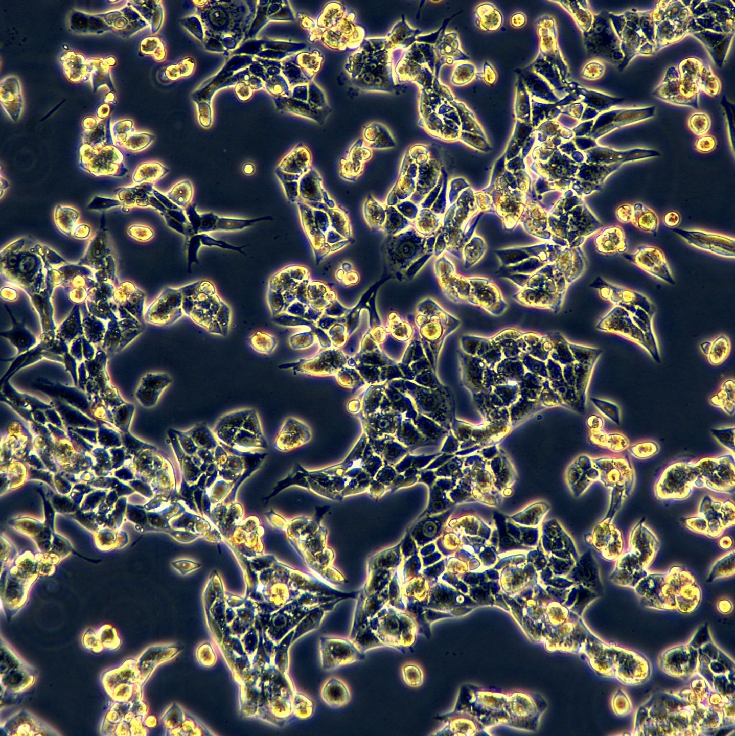 小鼠肾腺癌细胞 RENCA