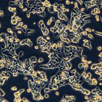 小鼠肾腺癌细胞 RENCA