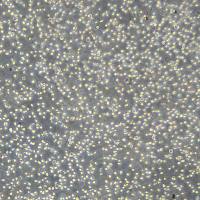 人外周血套细胞淋巴瘤细胞 JeKo-1