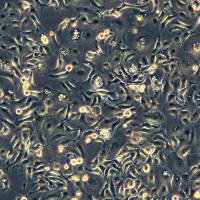 口腔鳞状肿瘤细胞 HSC-2