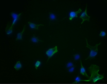 Epigentek-AURKA重组单克隆抗体[1H8]：科研好物低价抢！