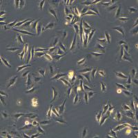 人外阴癌细胞 SW962