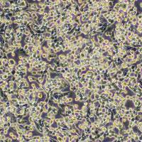 LLC 小鼠肺癌细胞