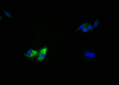 Epigentek-TP53重组单克隆抗体[3D4]：全场特惠