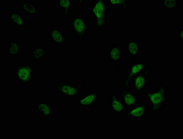 Epigentek-CDC5L重组单克隆抗体[1E3]，限时促销来袭！