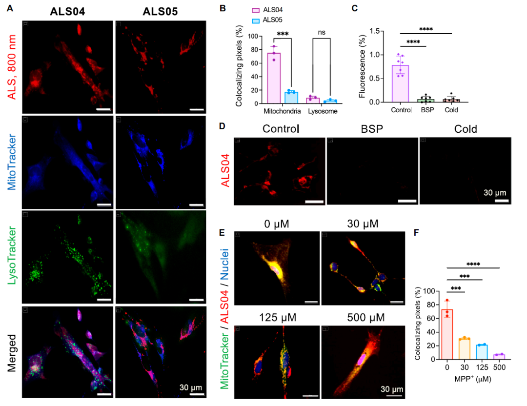 将实验效率提升 30%，Cytation 5 助力渐冻症早期诊断标志物开发