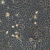 人乳腺癌细胞 HCC1937