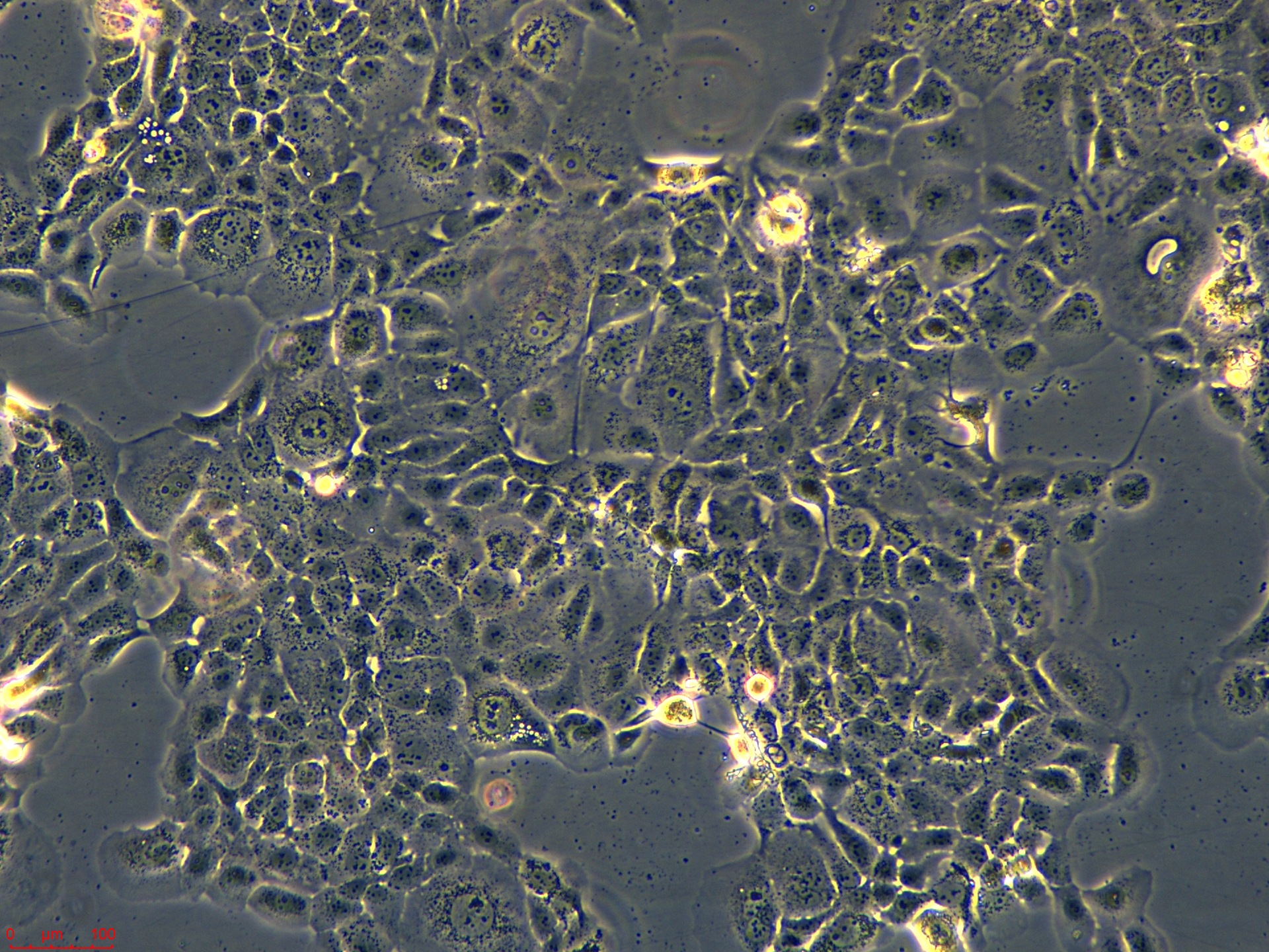 Project_HCC1937_ch00 (3).jpg