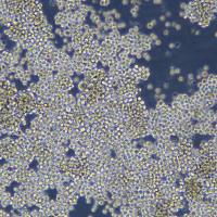 非小细胞肺癌细胞 NCI-H2106