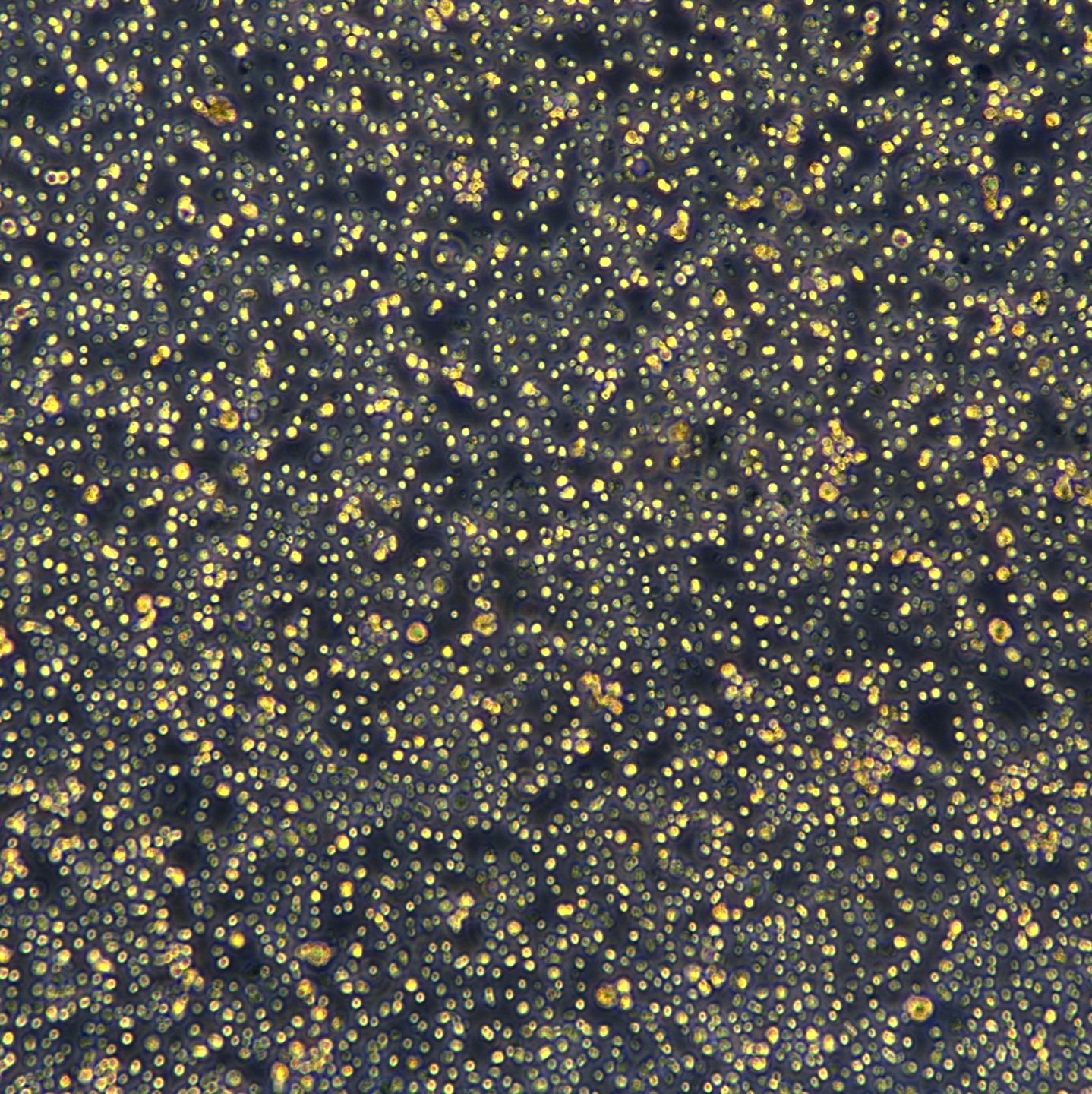 浙江美森-人皮肤T淋巴细胞瘤细胞 HH