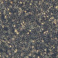 大鼠肾上腺嗜铬细胞瘤细胞(高分化) PC-12 （高分化）