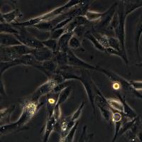 人骨骼肌永生化细胞 IHSMC（Immortalized Human Skeletal Muscle Cells）