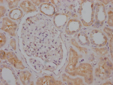 Epigentek-RPTOR重组单克隆抗体[1B10]，助力科研新突破