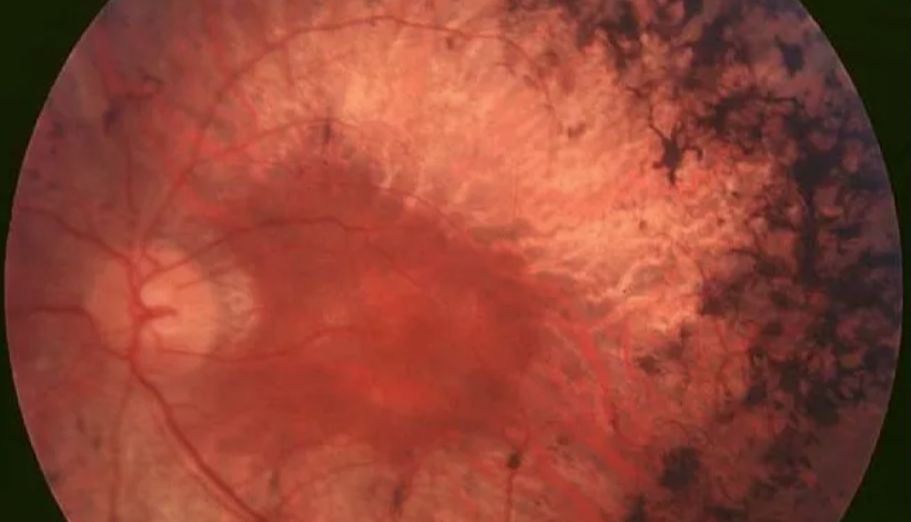 PeproTech在行动：支持视力恢复研究