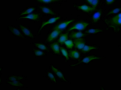 Epigentek-CCNE1重组单克隆抗体[9H12]，促销不容错过