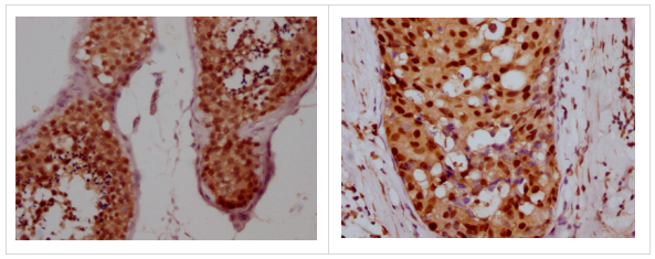 Epigentek-CCNE1重组单克隆抗体[3A5]开启科研采购狂欢