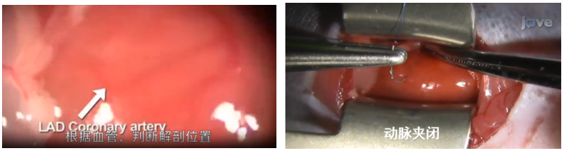 AAV研究指南-心脏和血管篇