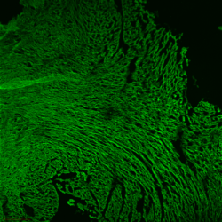AAV研究指南-心脏和血管篇