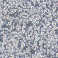 小鼠淋巴细胞白血病;L1210