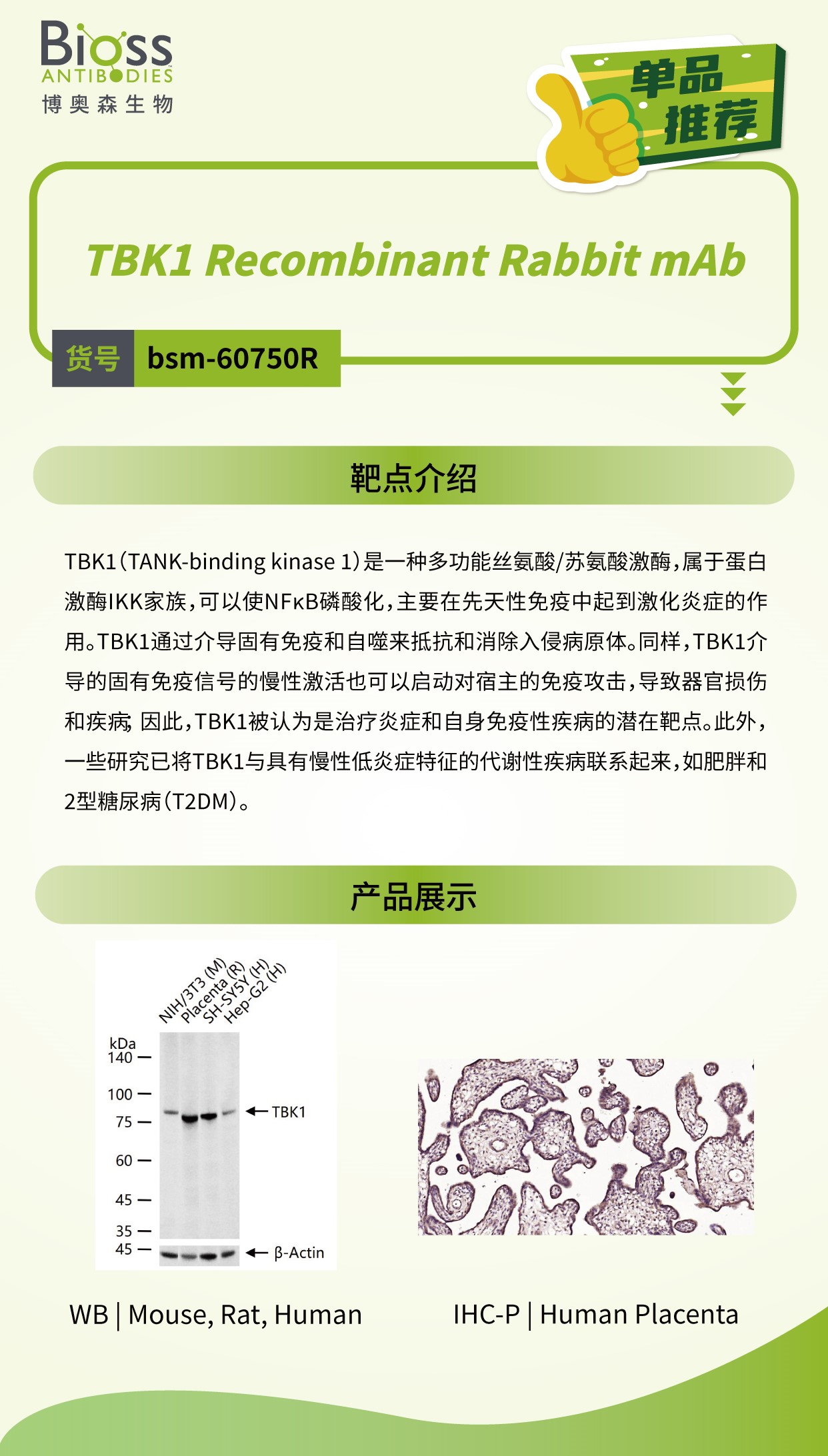 Bioss 星推荐 | TBK1 抗体