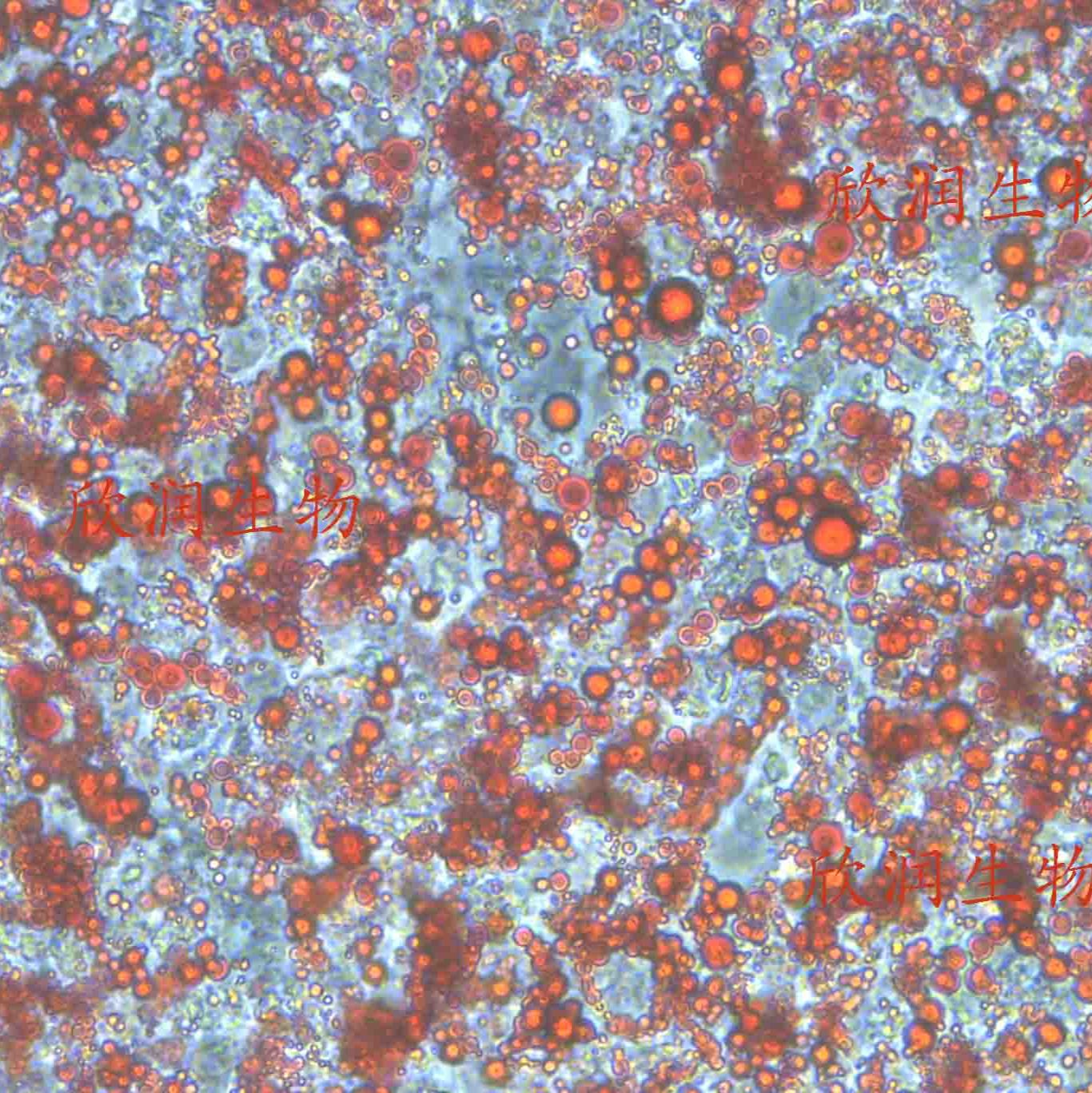 hADSC细胞、hADSCs永生化人脂肪间充质干细胞、永生化人脂肪干细胞、人脂肪间充质干细胞系、人脂肪干细胞系