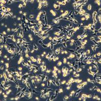 人神经胶质细胞瘤细胞 U-251MG