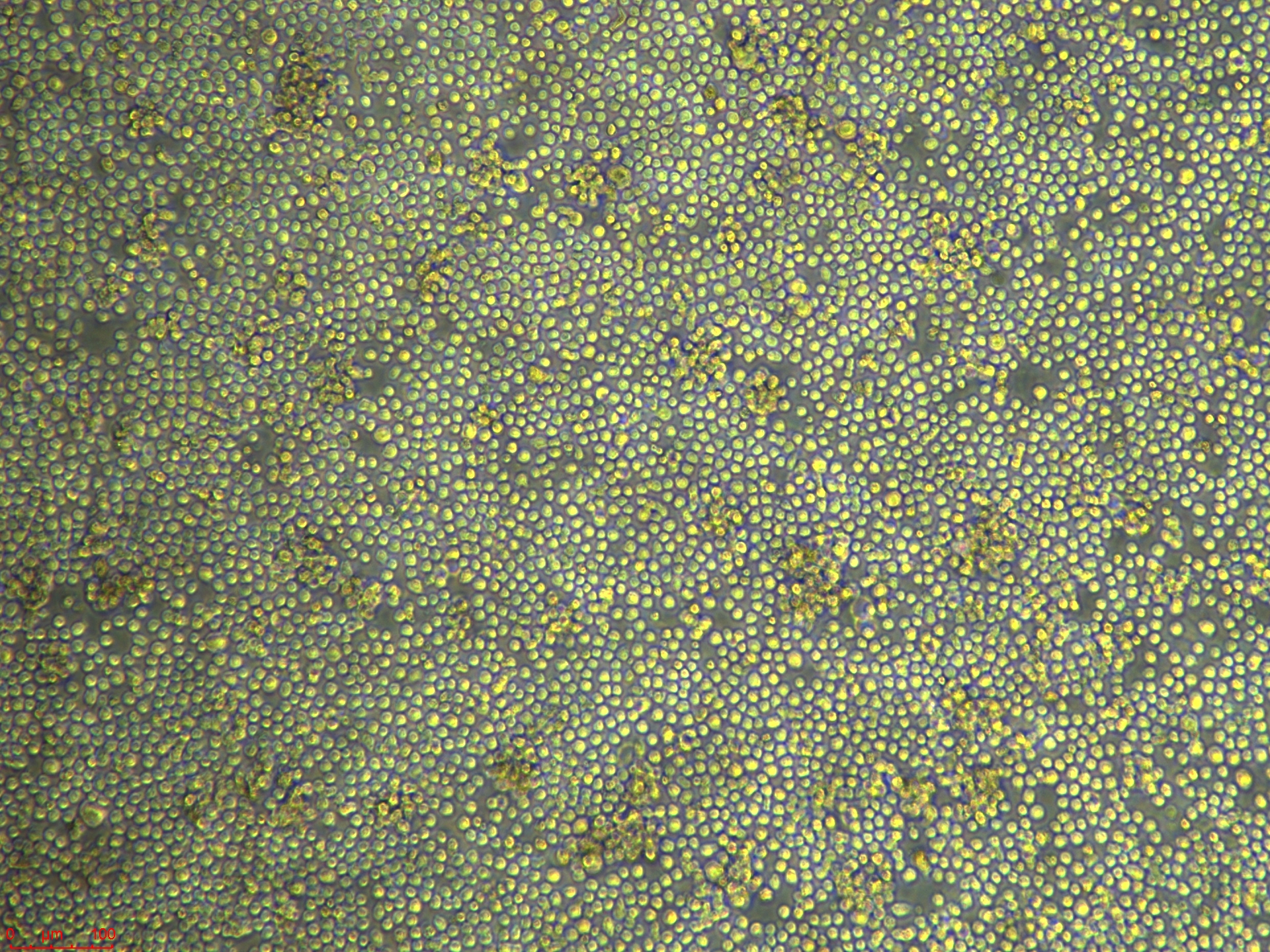 Project1001_Raji-luc  10X_ch00.jpg