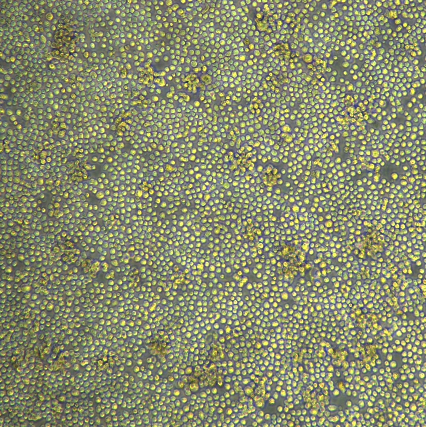 人EBV伯基特淋巴瘤 Raji