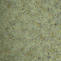 人EBV伯基特淋巴瘤 Raji