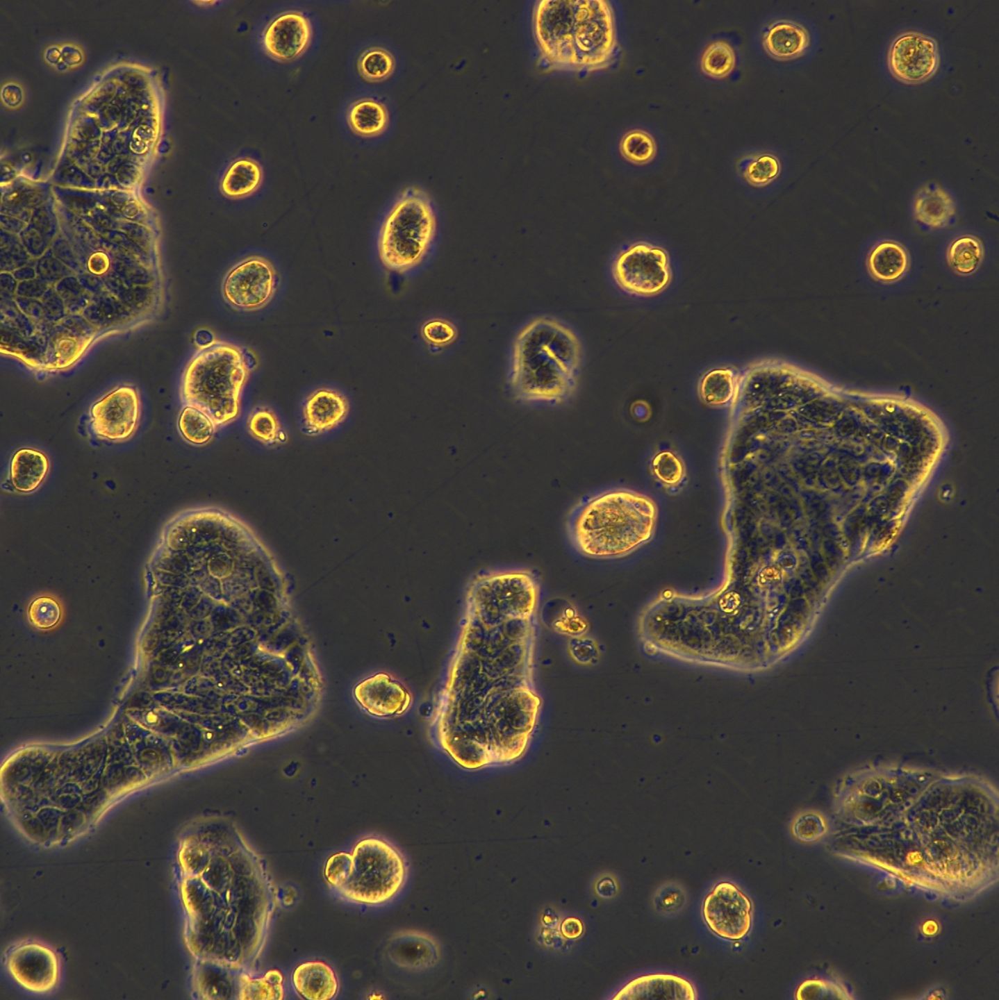 人肺腺癌细胞 Calu-3