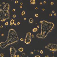 人肺腺癌细胞 Calu-3