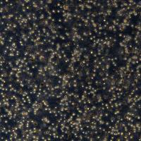 弥漫大B细胞淋巴瘤 SU-DHL-8