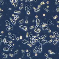 人肾上腺皮质癌 NCI-H295R