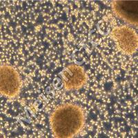 人淋巴母细胞系 Dakiki