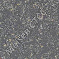 小细胞肺癌细胞 SBC-3