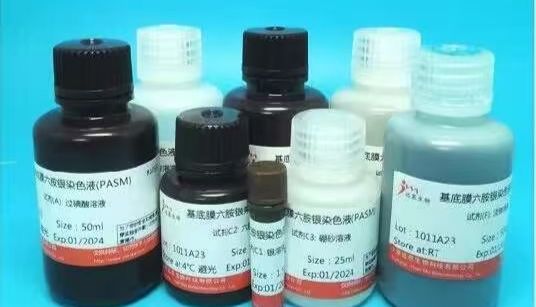 免疫组化染色常见问题的处理