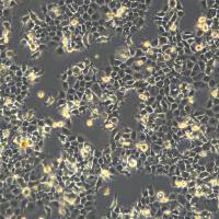 人咽鳞癌细胞 FADU(LUC1)