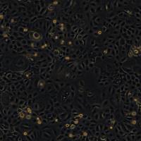 人食管鳞癌细胞 KYSE520