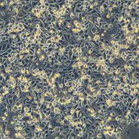 人胃癌细胞 SNU-601