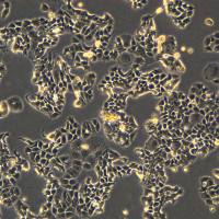 人乳腺管癌细胞 T-47D