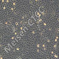  口腔鳞癌细胞 PE/CA-PJ41