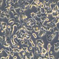 人食管鳞状细胞癌细胞 TE-14