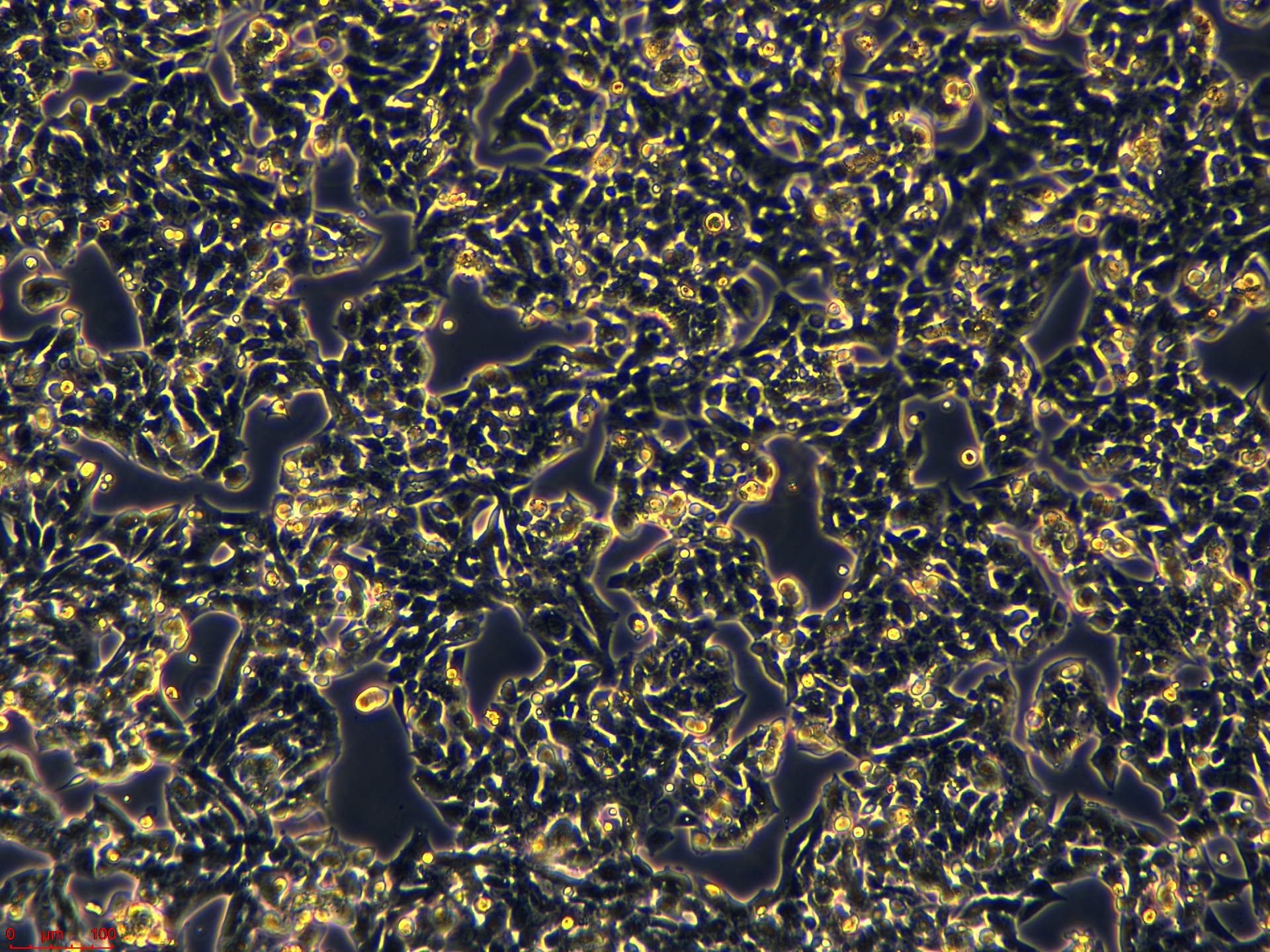 Project1001_NCI-H295R  10X_ch00.jpg