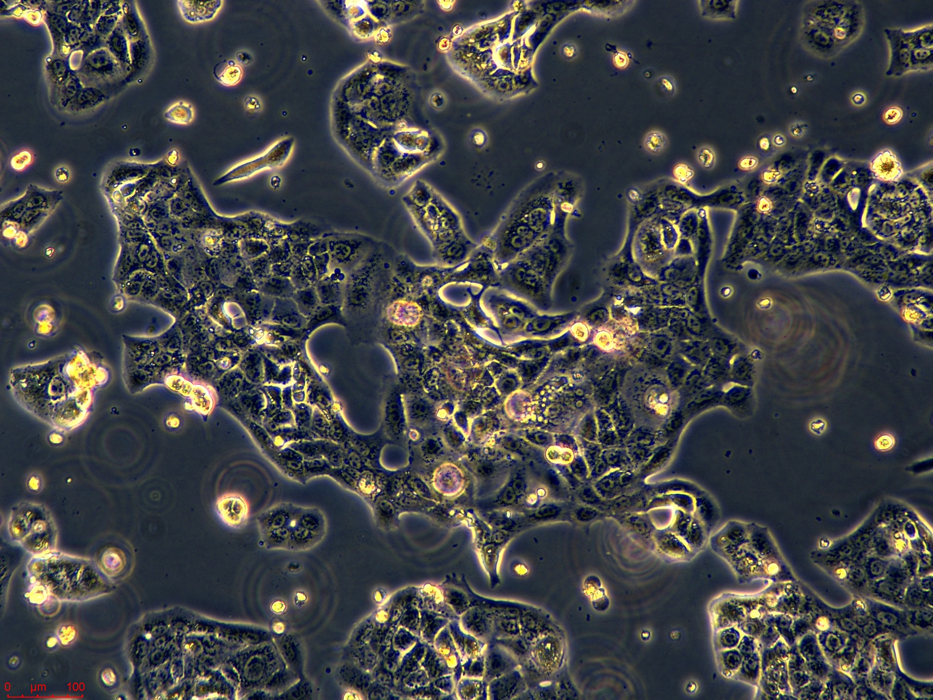 Project_NCI-H820_ch00 (3).jpg